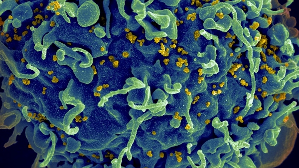 CRISPR відредагував гени всередині людського тіла CRISPR відредагував гени всередині людського тіла