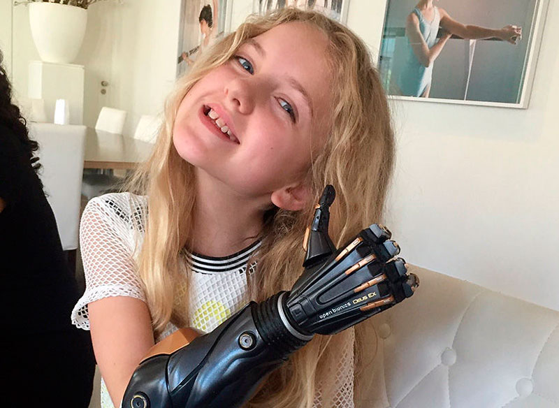 Фото: Open Bionics