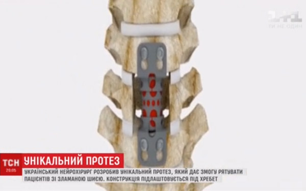 Унікальний винахід українця врятує мільйони життів Унікальний винахід українця врятує мільйони життів