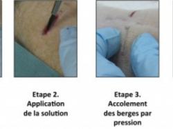 Фото: CNRS/ESPCI Paris Tech